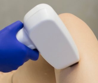 Jakie zalety ma depilacja laserowa?